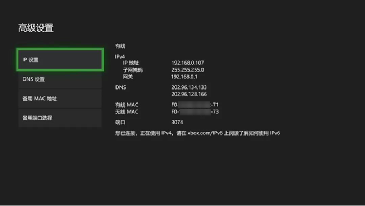 Xbox One联机VPN需求揭秘，真相大起底,Xbox One联机与VPN,xboxone联机需要vpn吗,VPN服,VPN的,使用VPN连接,第1张